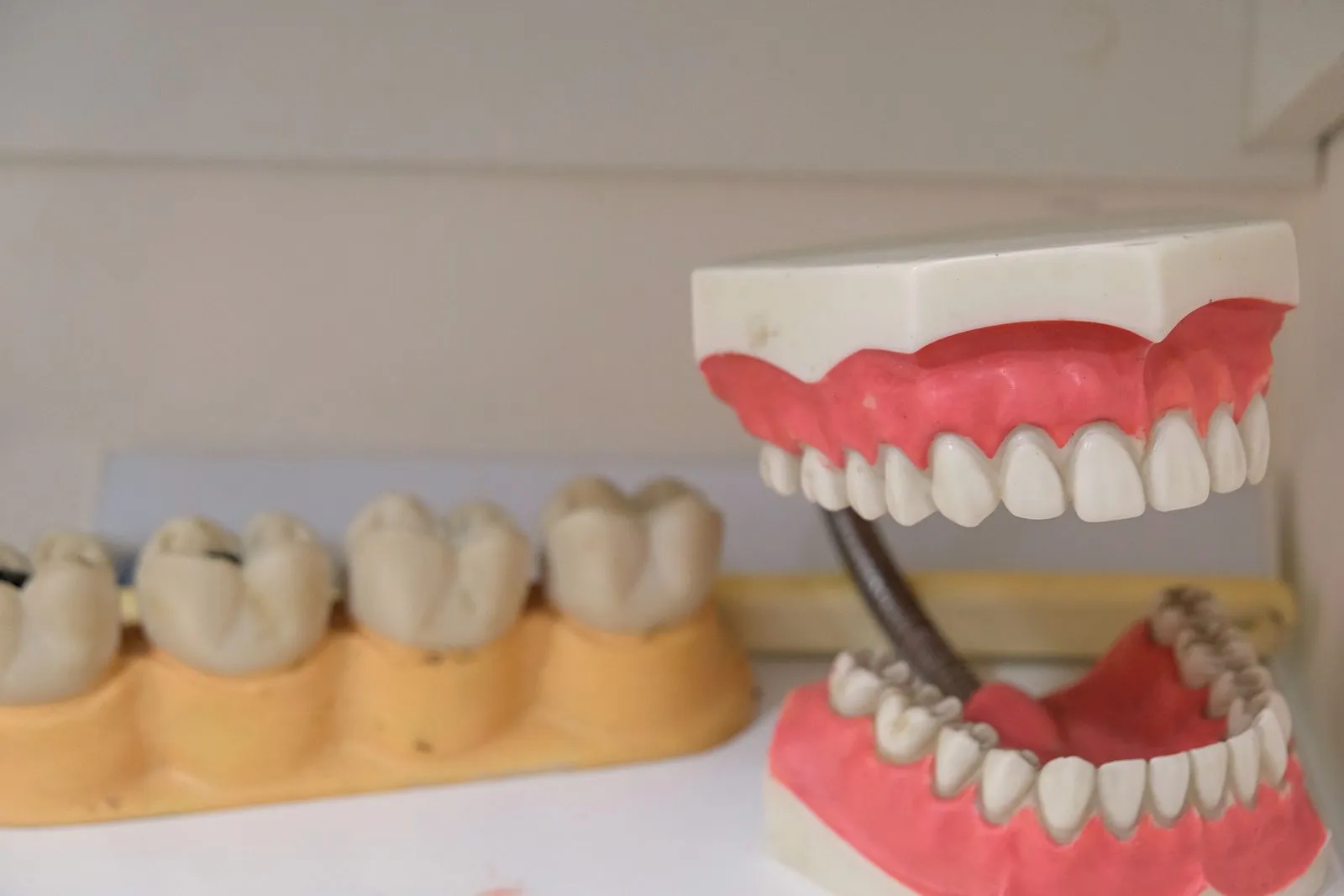 Prótesis dental de laboratorio sobre modelo, representando la rehabilitación en la Clínica Dentalcom
